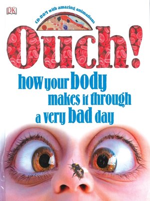 cover image of Ouch